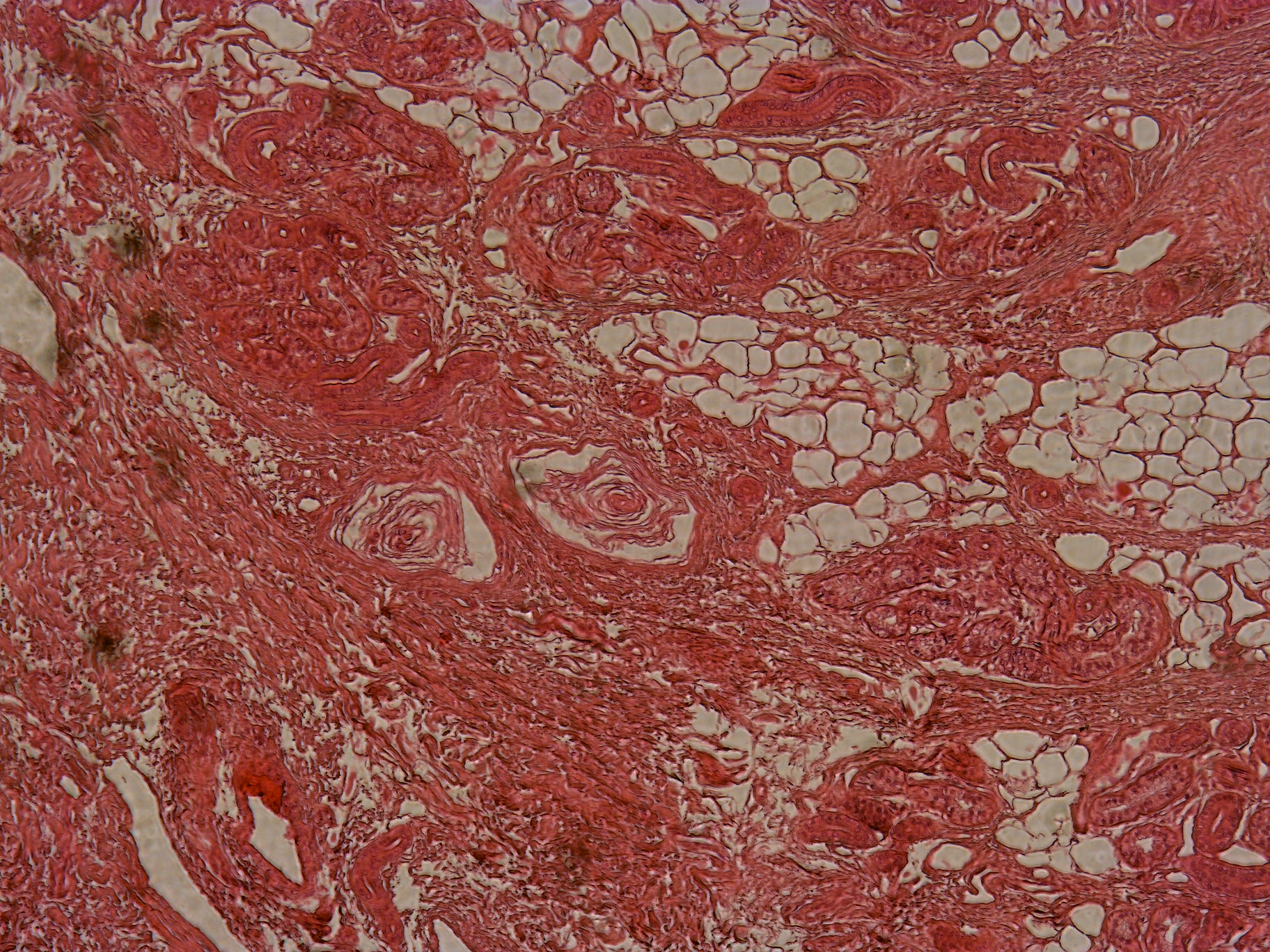 Interactive Experience